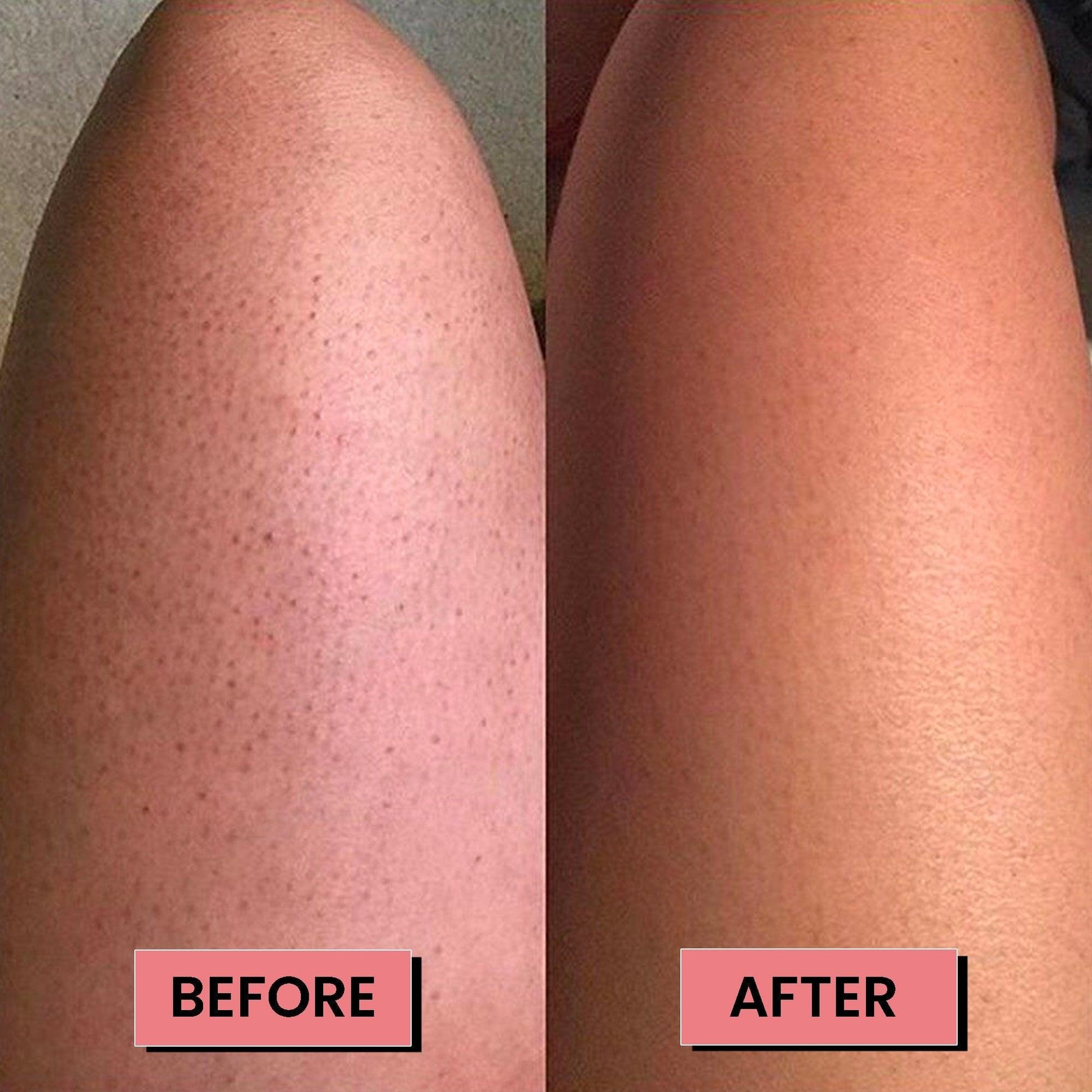 Exfoliating Glove - Mongant